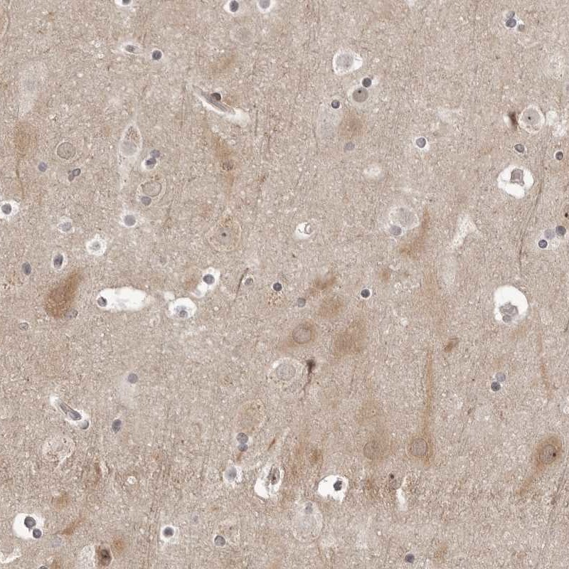 Anti-PTK2B Antibody