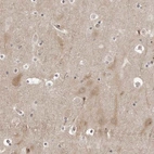 Anti-PTK2B Antibody