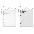 Western blot analysis using Anti-PTK2B antibody HPA026276 (A) shows similar pattern to independent antibody HPA026091 (B).