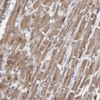 Immunohistochemical staining of human heart muscle shows moderate cytoplasmic positivity in cardiomyocytes.