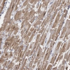 Immunohistochemical staining of human heart muscle shows moderate cytoplasmic positivity in cardiomyocytes.