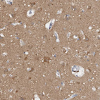 Immunohistochemical staining of human cerebral cortex shows moderate cytoplasmic positivity in neuropil and neurons.