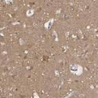 Immunohistochemical staining of human cerebral cortex shows moderate cytoplasmic positivity in neuropil and neurons.