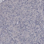 Immunohistochemical staining of human pancreas shows no positivity in exocrine glandular cells as expected.