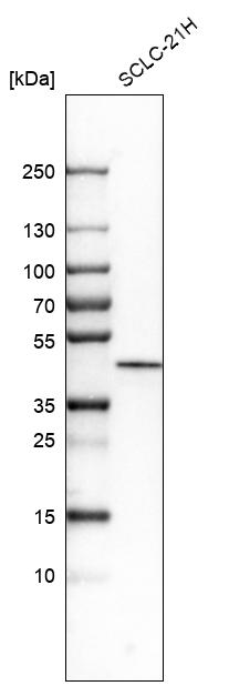 Anti-CSNK1E Antibody