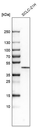 Anti-CSNK1E Antibody