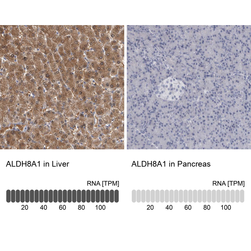 Anti-ALDH8A1 Antibody