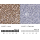 Anti-ALDH8A1 Antibody