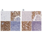 Immunohistochemical staining of human cerebral cortex, kidney, liver and lymph node using Anti-ALDH8A1 antibody HPA026292 (A) shows similar protein distribution across tissues to independent antibody HPA055414 (B).