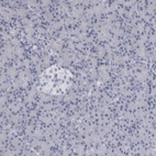 Anti-ALDH8A1 Antibody