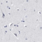 Immunohistochemical staining of human cerebral cortex using Anti-ALDH8A1 antibody HPA026292.