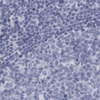Anti-ALDH8A1 Antibody