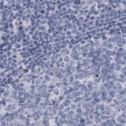 Immunohistochemical staining of human lymph node using Anti-ALDH8A1 antibody HPA026292.