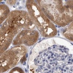 Immunohistochemical staining of human kidney using Anti-ALDH8A1 antibody HPA026292.