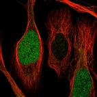 Immunofluorescent staining of human cell line U-2 OS shows localization to nucleoplasm.