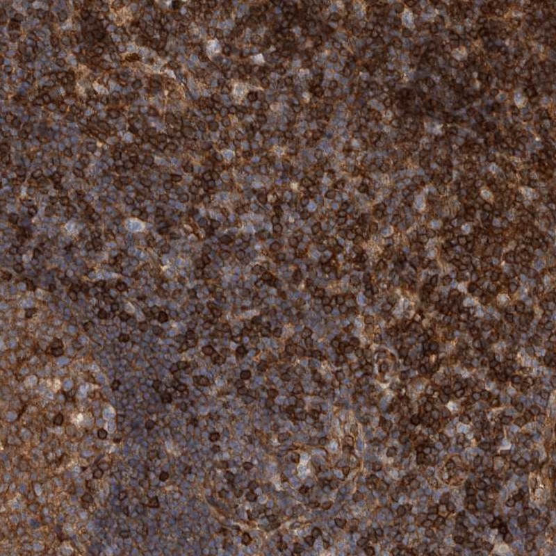 Anti-PRKCH Antibody