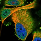 Immunofluorescent staining of human cell line U-251 MG shows localization to plasma membrane & cytosol.