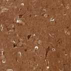 Immunohistochemical staining of human cerebral cortex shows strong cytoplasmic positivity in neurons.