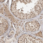 Immunohistochemical staining of human testis shows moderate cytoplasmic positivity in Leydig cells.