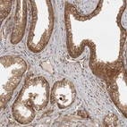 Immunohistochemical staining of human prostate shows moderate cytoplasmic positivity in glandular cells.