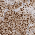 Anti-RPA2 Antibody