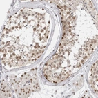 Immunohistochemical staining of human Testis shows moderate nuclear positivity in cells in seminiferous ducts and Leydig cells.