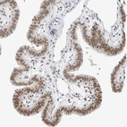 Immunohistochemical staining of human Fallopian tube shows moderate nuclear positivity in glandular cells.