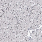 Immunohistochemical staining of human Liver shows very weak nuclear positivity in hepatocytes.
