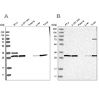 Western blot analysis using Anti-RPA2 antibody HPA026306 (A) shows similar pattern to independent antibody HPA026309 (B).