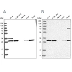 Western blot analysis using Anti-RPA2 antibody HPA026306 (A) shows similar pattern to independent antibody HPA026309 (B).