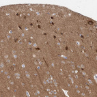 Immunohistochemical staining of human cerebral cortex shows moderate to strong cytoplasmic positivity in neurons.