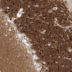 Immunohistochemical staining of human cerebellum shows moderate to strong cytoplasmic positivity in Purkinje cells.