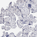 Immunohistochemical staining of human placenta shows no positivity in trophoblastic cells as expected.