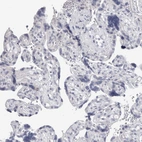 Immunohistochemical staining of human placenta shows no positivity in trophoblastic cells as expected.