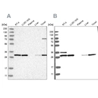 Western blot analysis using Anti-RPA2 antibody HPA026309 (A) shows similar pattern to independent antibody HPA026306 (B).