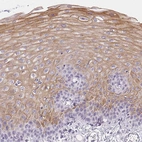 Immunohistochemical staining of human esophagus shows moderate cytoplasmic positivity in squamous epithelial cells.