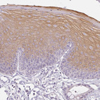 Immunohistochemical staining of human skin shows moderate cytoplasmic positivity in squamous epithelial cells.