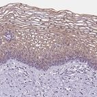 Immunohistochemical staining of human uterine cervix shows weak to moderate cytoplasmic positivity in squamous epithelial cells.