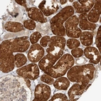 Immunohistochemical staining of human kidney shows strong cytoplasmic positivity in cells in tubules.