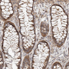 Immunohistochemical staining of human colon shows strong cytoplasmic positivity in glandular cells.