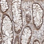 Immunohistochemical staining of human colon shows strong cytoplasmic positivity in glandular cells.