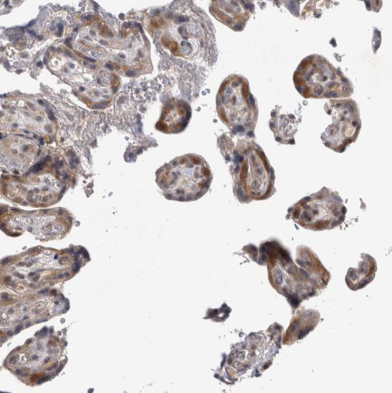 Anti-PSMB2 Antibody