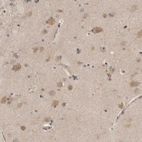 Immunohistochemical staining of human cerebral cortex shows weak to moderate cytoplasmic positivity in neurons.