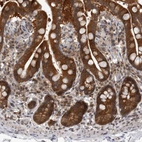 Immunohistochemical staining of human colon shows strong cytoplasmic positivity in glandular cells.