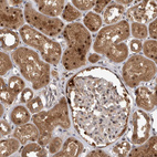 Immunohistochemical staining of human kidney shows moderate to strong nuclear and cytoplasmic positivity in cells in tubules.