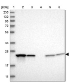 Lane 1: Marker [kDa] 230, 130, 95, 72, 56, 36, 28, 17, 11_br/_Lane 2: Human cell line RT-4_br/_Lane 3: Human cell line U-251MG sp_br/_Lane 4: Human plasma (IgG/HSA depleted)_br/_Lane 5: Human liver tissue_br/_Lane 6: Human tonsil tissue