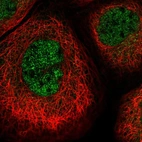Immunofluorescent staining of human cell line A-431 shows localization to nucleoplasm.
