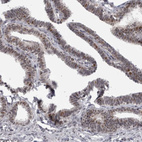 Anti-PSMB2 Antibody