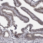 Anti-PSMB2 Antibody