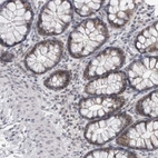 Immunohistochemical staining of human colon shows moderate nuclear positivity in glandular cells.